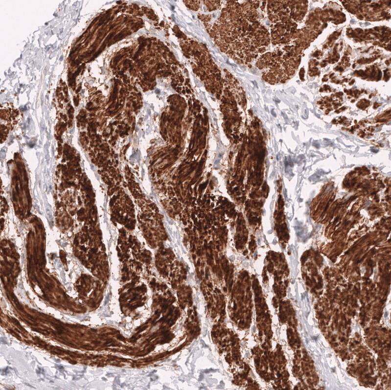 Staining of human smooth muscle shows strong cytoplasmic positivity in smooth muscle cells.