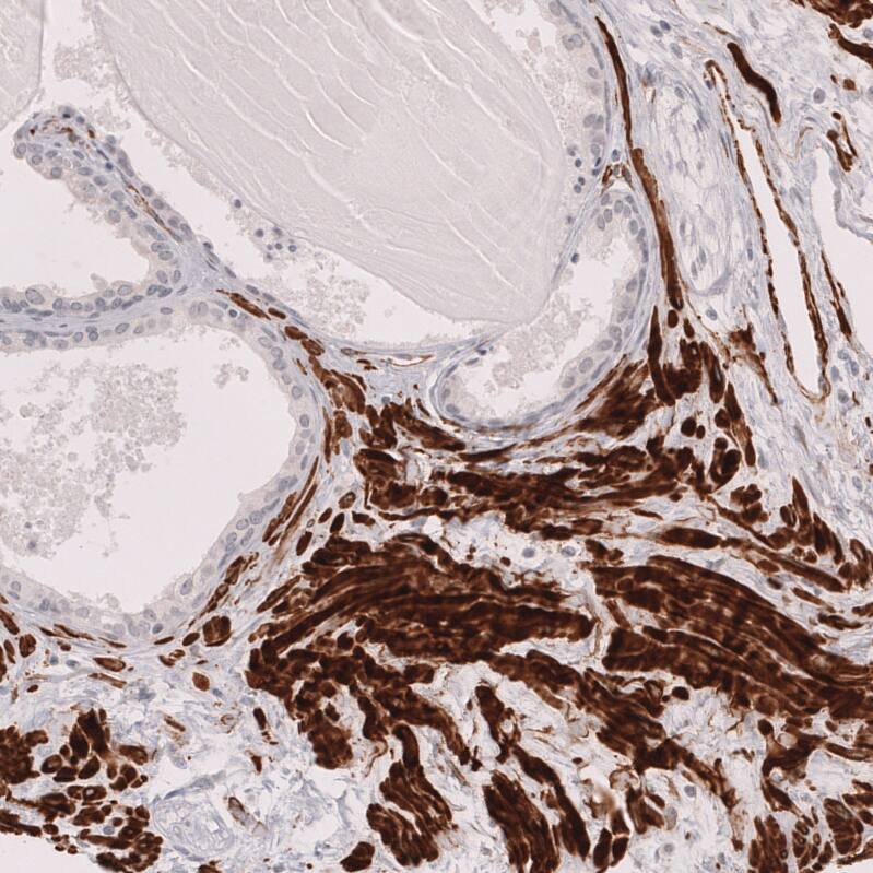 Staining of human prostate shows strong cytoplasmic positivity in smooth muscle cells.