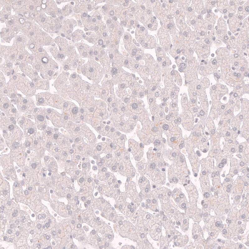 Staining of human liver shows no positivity in hepatocytes as expected.