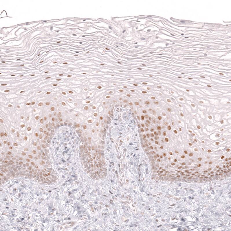 Staining of human cervix shows moderate nuclear positivity in squamous epithelial cells.