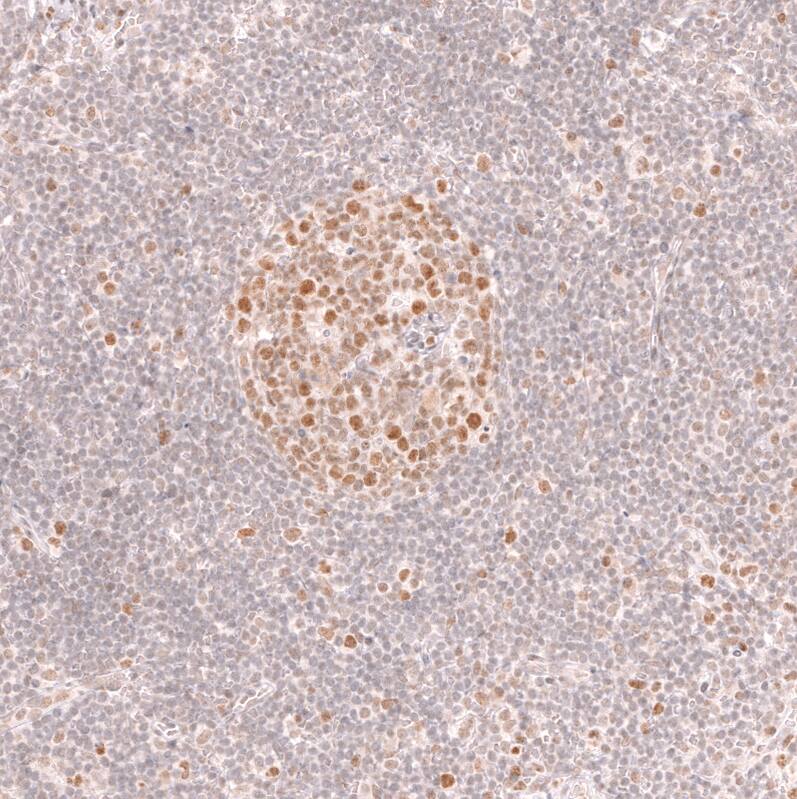 Staining of human lymph node shows moderate to strong nuclear positivity in germinal center cells.