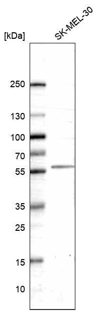 Analysis in human cell line SK-MEL-30.