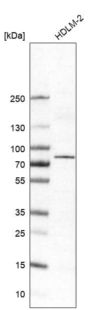 Analysis in human cell line HDLM-2.