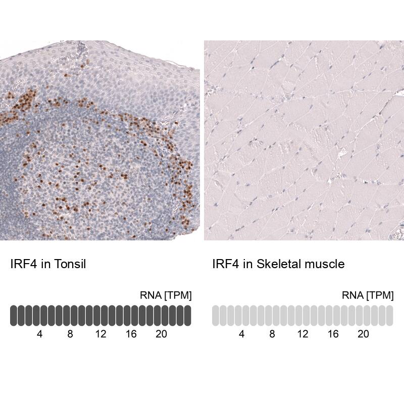 Analysis in human tonsil and skeletal muscle tissues using NBP3-44146 antibody. Corresponding IRF4 RNA-seq data are presented for the same tissues.