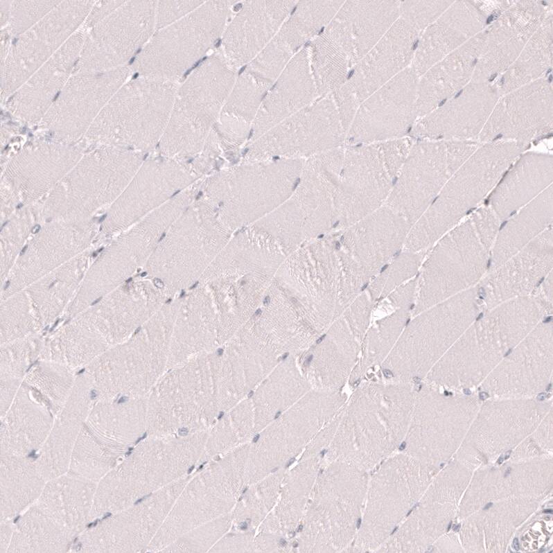 Staining of human skeletal muscle shows no positivity in myocytes as expected.