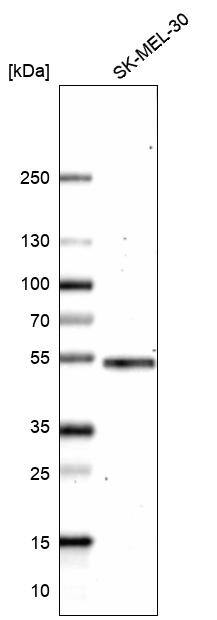 Analysis in human cell line SK-MEL-30.
