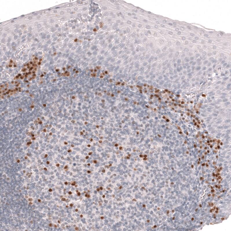 Staining of human tonsil shows strong nuclear positivity in lymphoid cells.