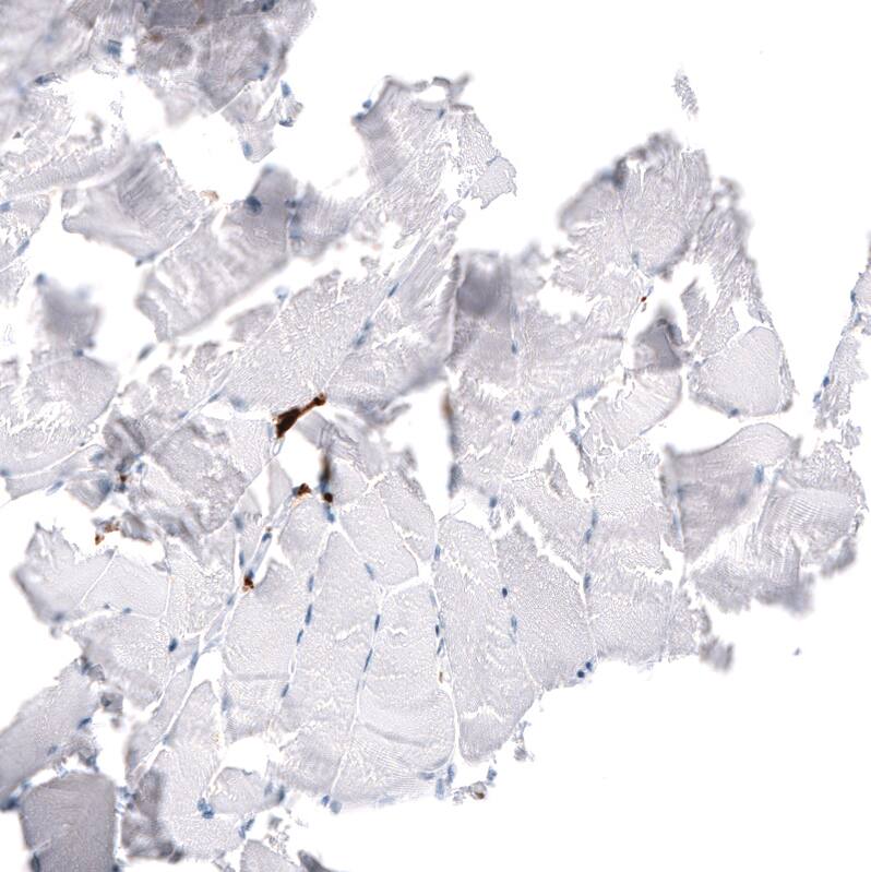 Staining of human skeletal muscle shows no positivity in myocytes as expected.