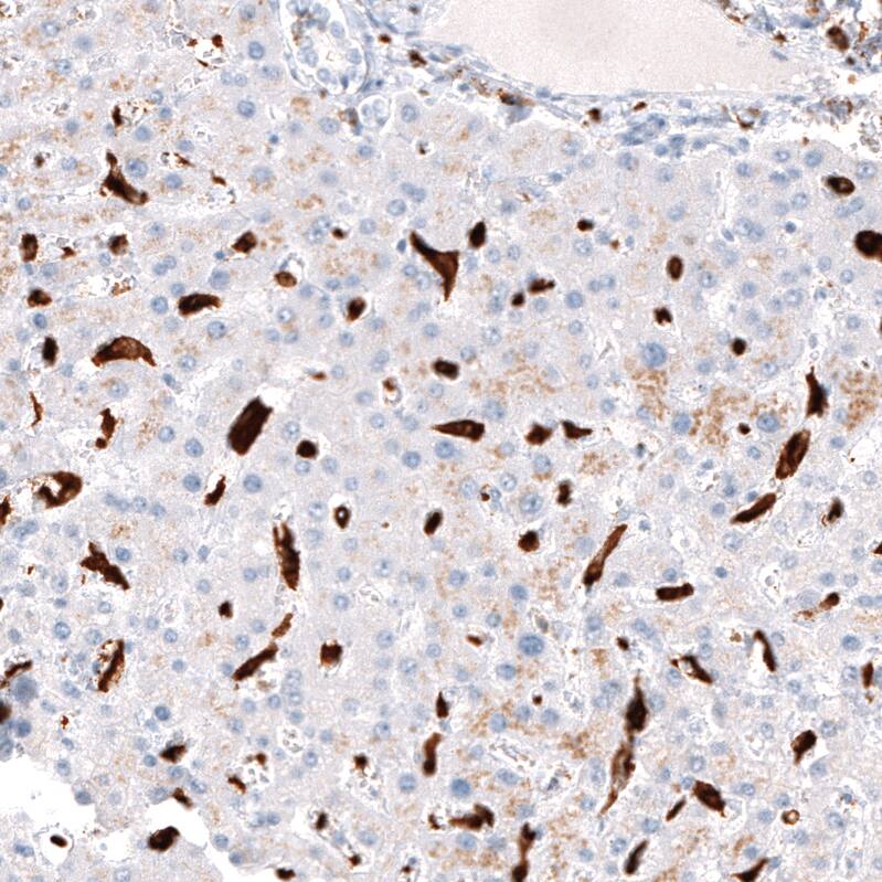 Staining of human liver shows strong cytoplasmic positivity in Kupffer cells.