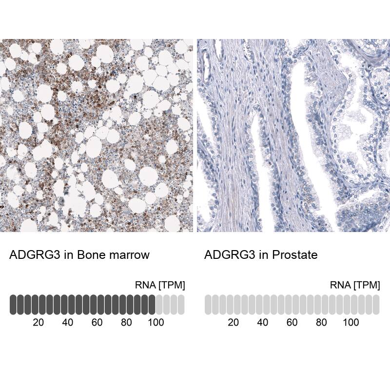 Analysis in human bone marrow and prostate tissues using NBP3-44149 antibody. Corresponding GPR97 RNA-seq data are presented for the same tissues.