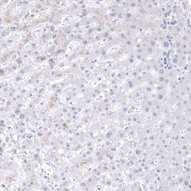 Staining of human Liver shows no positivity in hepatocytes as expected.