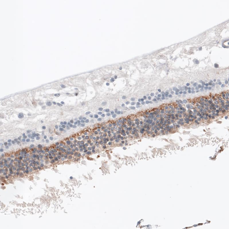 Staining of human retina shows moderate positivity in the outer plexiform layer.