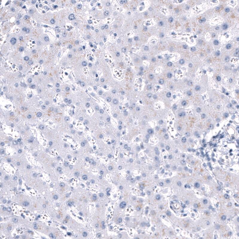 Staining of human liver shows no positivity in hepatocytes as expected.