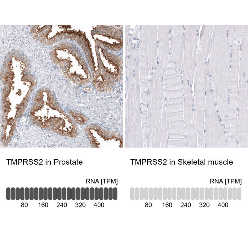 Analysis in human prostate and skeletal muscle tissues using NBP3-44152 antibody. Corresponding TMPRSS2 RNA-seq data are presented for the same tissues.