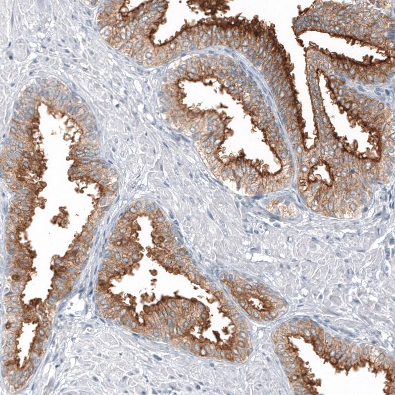 Staining of human prostate shows strong membranous positivity in glandular cells.