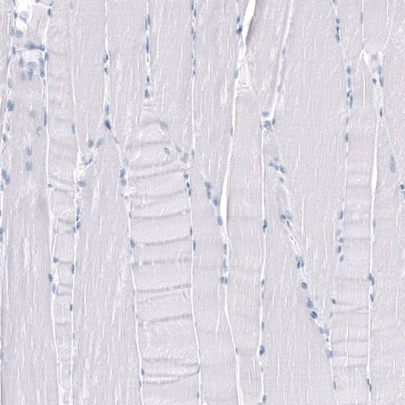 Staining of human skeletal muscle shows no positivity in myocytes as expected.