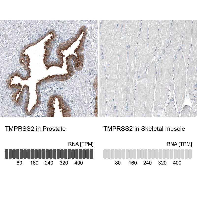 Analysis in human prostate and skeletal muscle tissues using NBP3-44154 antibody. Corresponding TMPRSS2 RNA-seq data are presented for the same tissues.