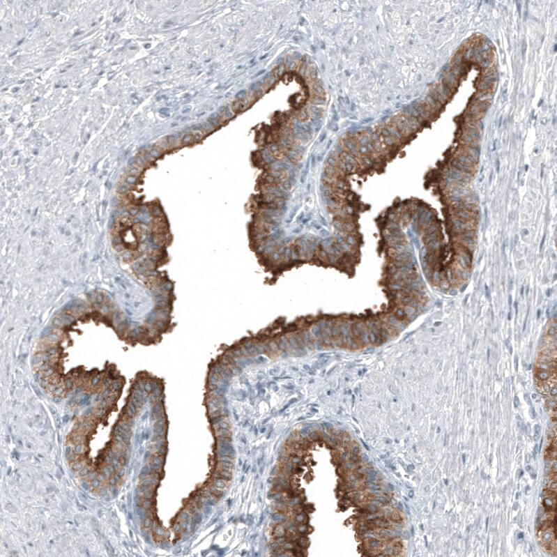 Staining of human prostate shows strong membranous positivity in glandular cells.