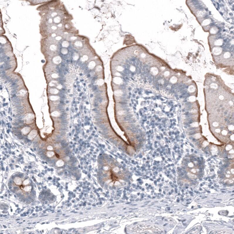 Staining of human small intestine shows moderate to strong membranous positivity in glandular cells.