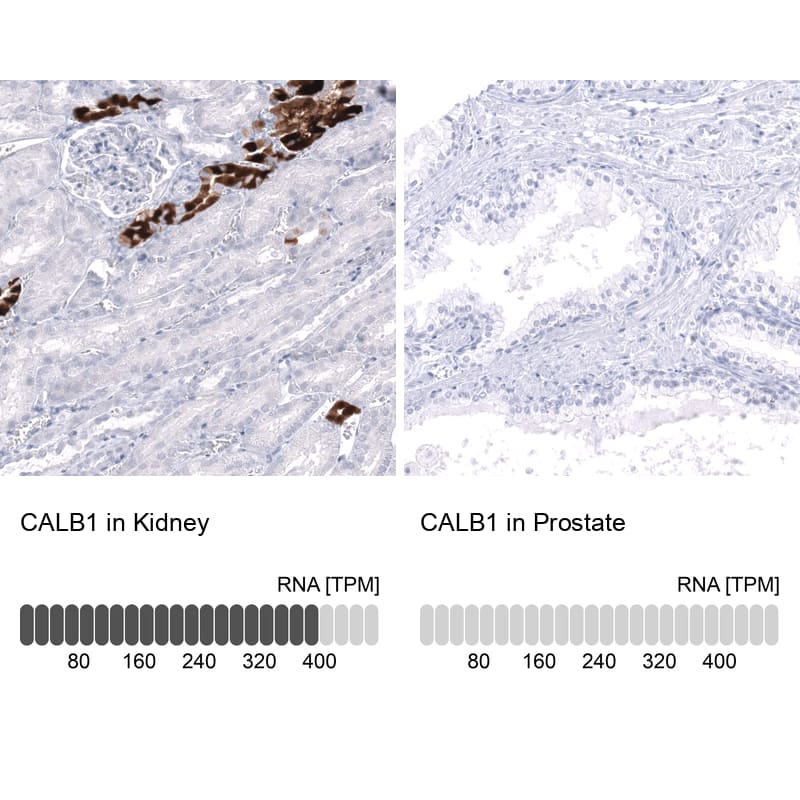 Analysis in human kidney and prostate tissues using NBP3-44160 antibody. Corresponding Calbindin D-28K RNA-seq data are presented for the same tissues.
