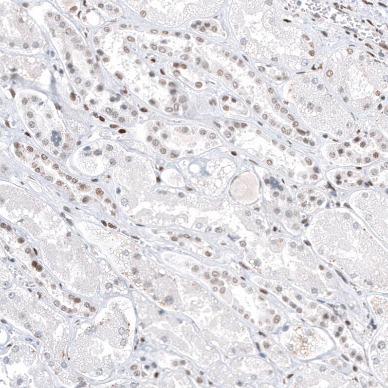 Staining of human kidney shows weak to moderate nuclear positivity in cells in tubules.