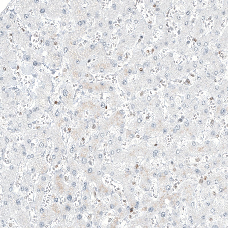 Staining of human liver shows no positivity in hepatocytes as expected.