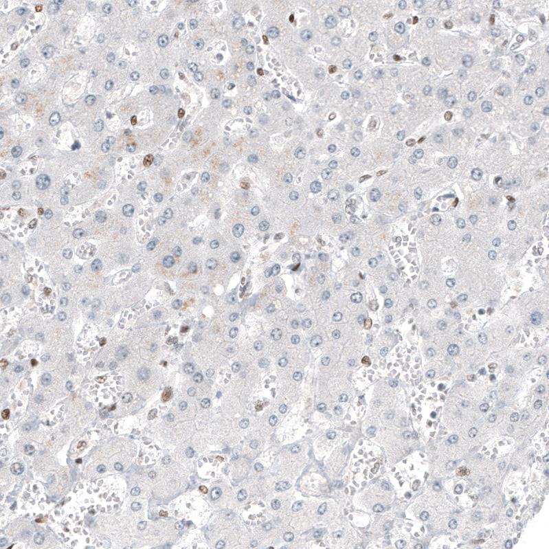 Staining of human liver shows no positivity in hepatocytes as expected.