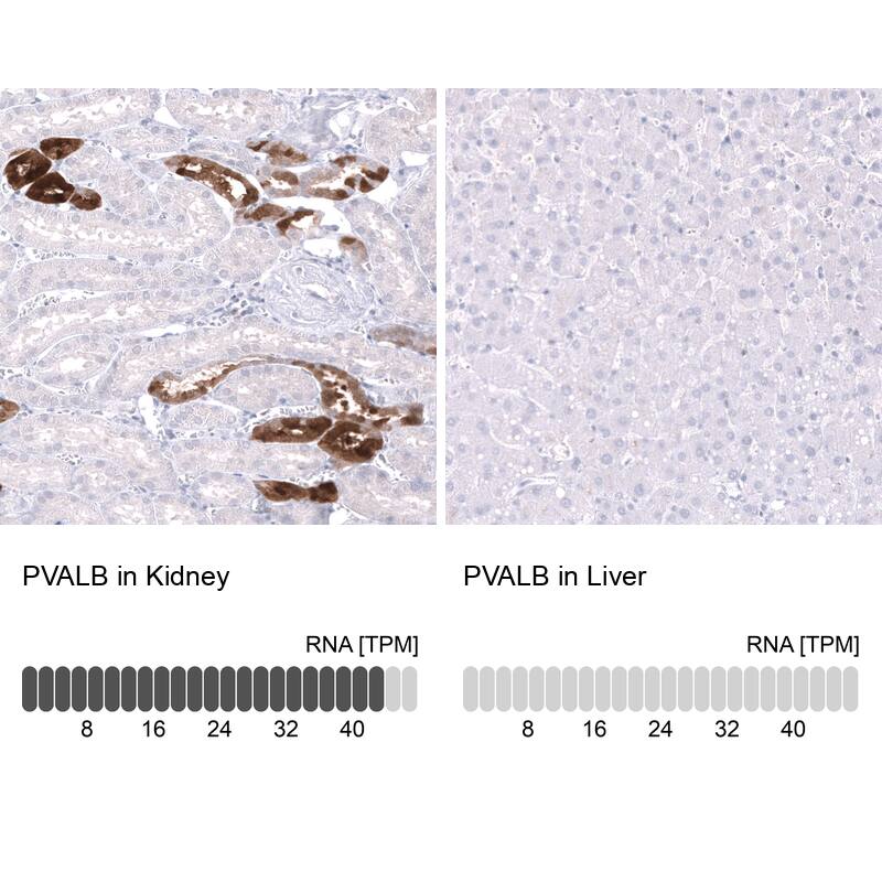 Analysis in human kidney and liver tissues using NBP3-44164 antibody. Corresponding Parvalbumin RNA-seq data are presented for the same tissues.