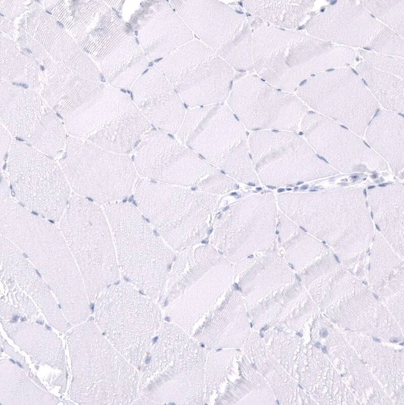 Staining of human skeletal muscle shows no positivity in myocytes as expected.