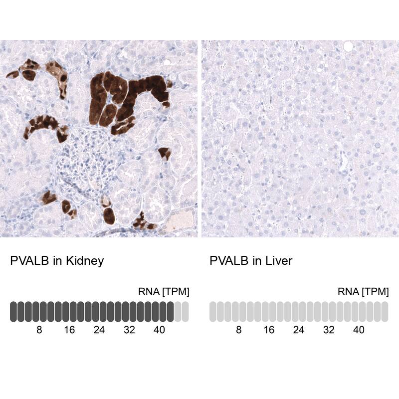 Analysis in human kidney and liver tissues using NBP3-44166 antibody. Corresponding Parvalbumin RNA-seq data are presented for the same tissues.