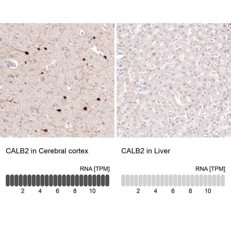 Analysis in human cerebral cortex and liver tissues using NBP3-44168 antibody. Corresponding Calretinin RNA-seq data are presented for the same tissues.