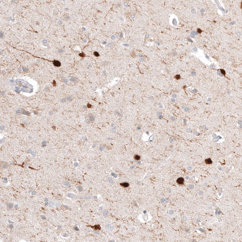 Staining of human cerebral cortex shows strong cytoplasmic positivity in a subset of neurons.