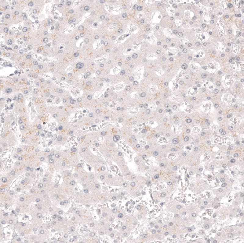 Staining of human liver shows no positivity in hepatocytes as expected.