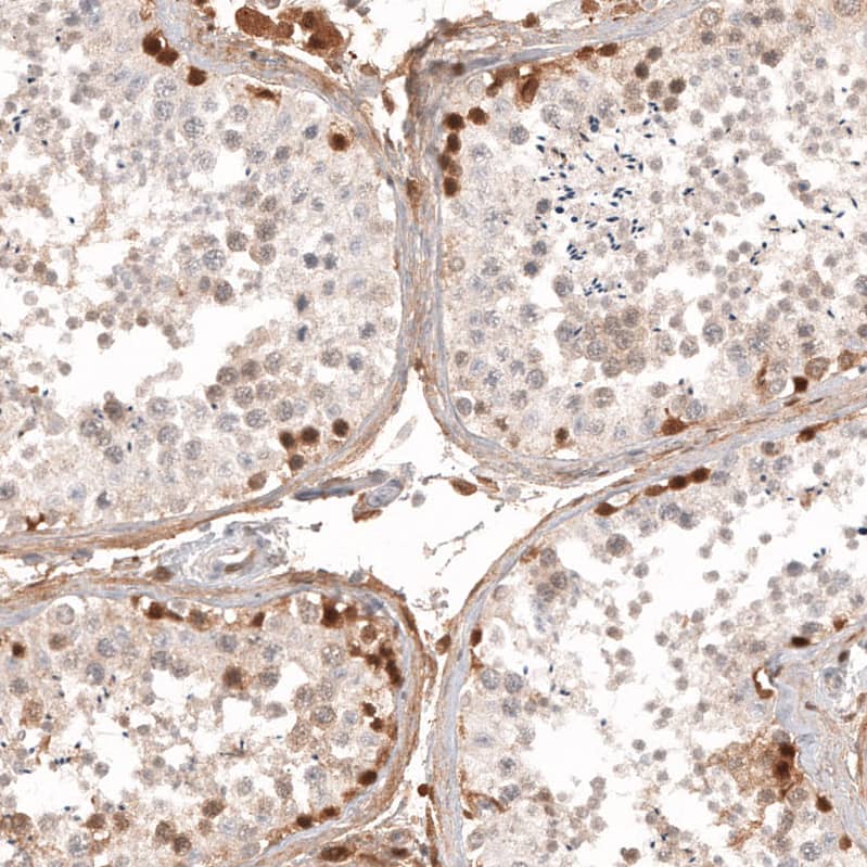 Staining of human testis shows strong cytoplasmic positivity in a subset of cells in seminiferous ducts.