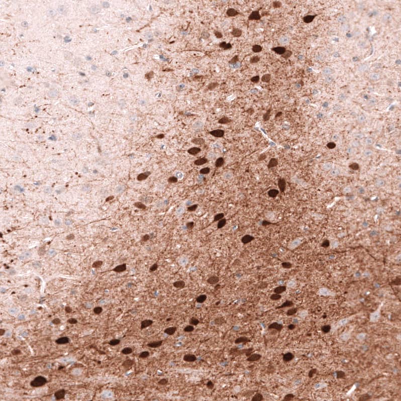 Staining of mouse brain shows strong cytoplasmic positivity in a subset of neurons.