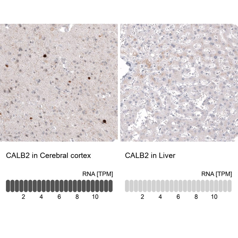 Analysis in human cerebral cortex and liver tissues using NBP3-44169 antibody. Corresponding Calretinin RNA-seq data are presented for the same tissues.