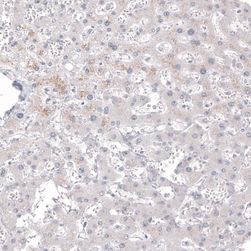 Staining of human liver shows no positivity in hepatocytes as expected.