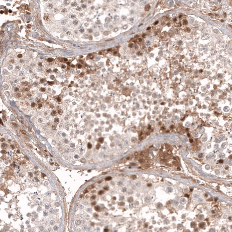 Staining of human testis shows moderate to strong cytoplasmic and nuclear positivity in cells in seminiferous ducts.