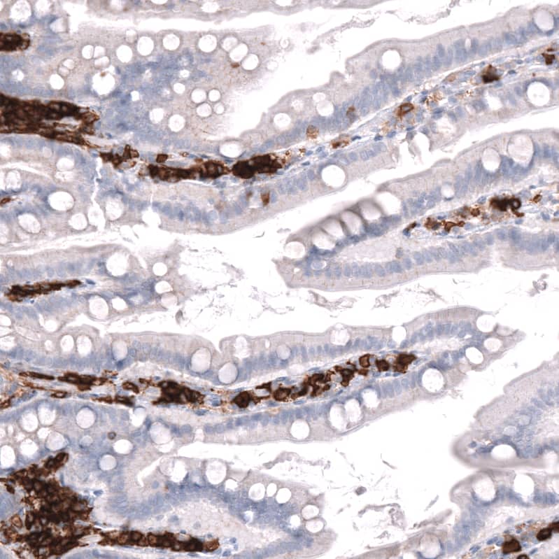 Staining of human duodenum shows strong membranous positivity in lymphoid cells.