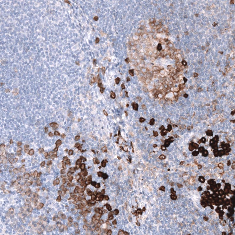 Staining of human lymph node shows strong membranous positivity in non-germinal center cells and moderate membranous positivity in germinal center cells.