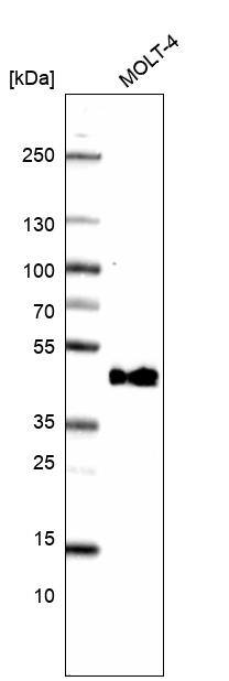 Analysis in human cell line MOLT-4.