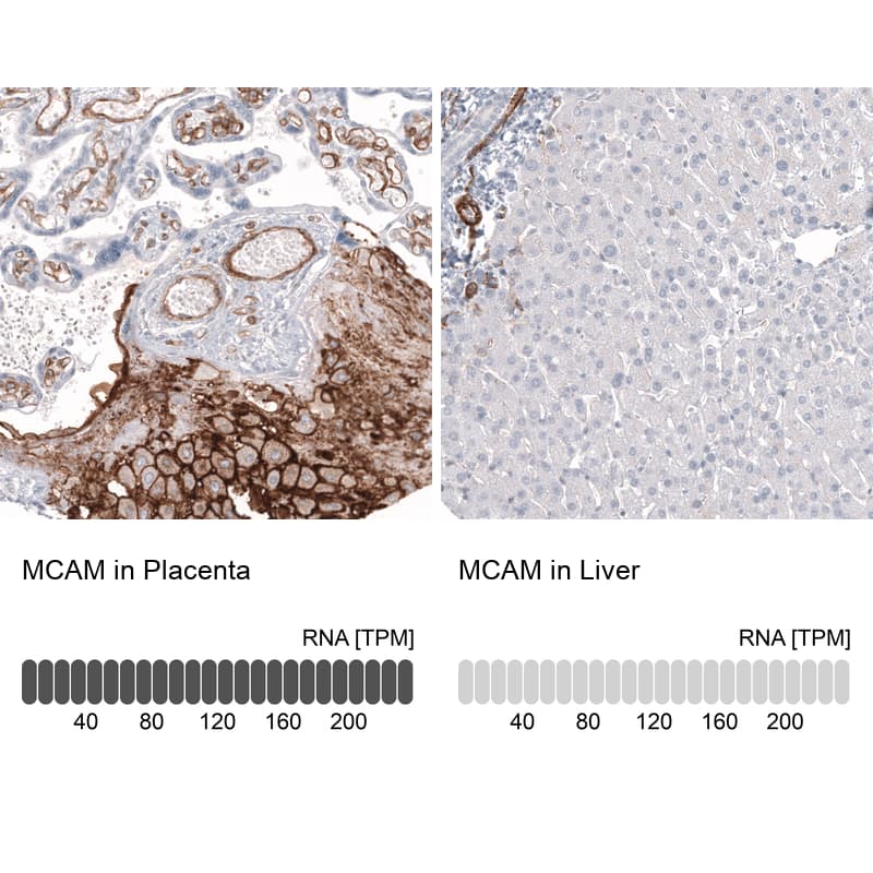 Analysis in human placenta and liver tissues using NBP3-44171 antibody. Corresponding MCAM/CD146 RNA-seq data are presented for the same tissues.