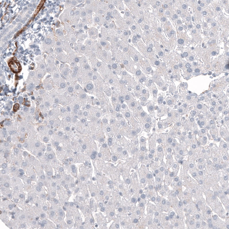 Staining of human liver shows no positivity in hepatocytes as expected.