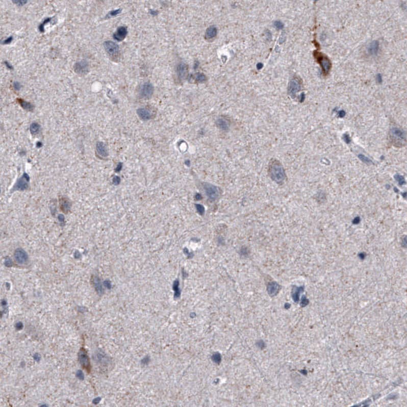 Staining of human cerebral cortex shows weak to moderate cytoplasmic positivity in a subset of neurons.