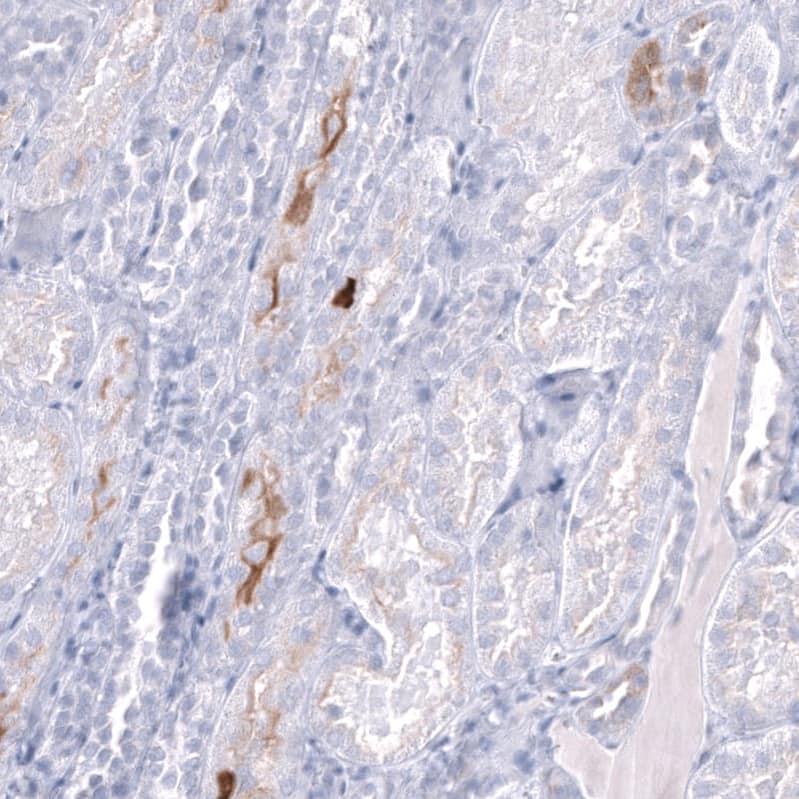 <b>Orthogonal Strategies Validation. </b>Staining of human kidney shows moderate cytoplasmic positivity in cells in tubules.