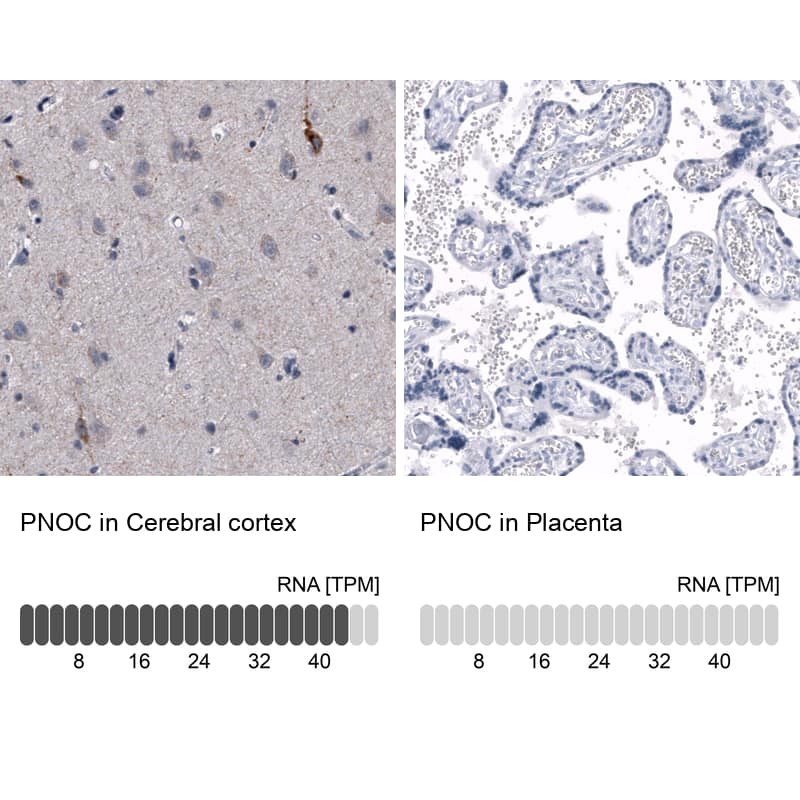 Immunohistochemistry-Paraffin Nociceptin Antibody (CL15085) - Azide and BSA Free