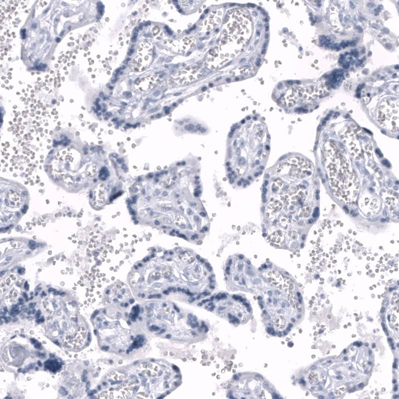 Staining of human placenta shows no positivity in trophoblastic cells as expected.