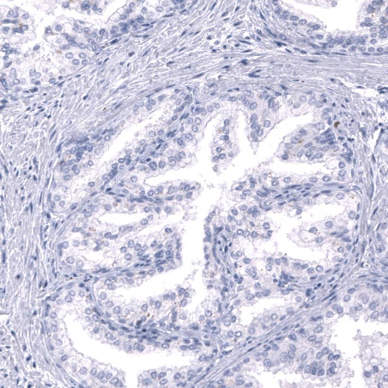 Staining of human prostate shows no positivity in glandular cells as expected.