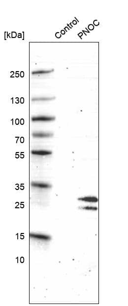 Analysis in control (vector only transfected HEK293T lysate) and Nociceptin over-expression lysate (Co-expressed with a C-terminal myc-DDK tag (~3.1 kDa) in mammalian HEK293T cells) .