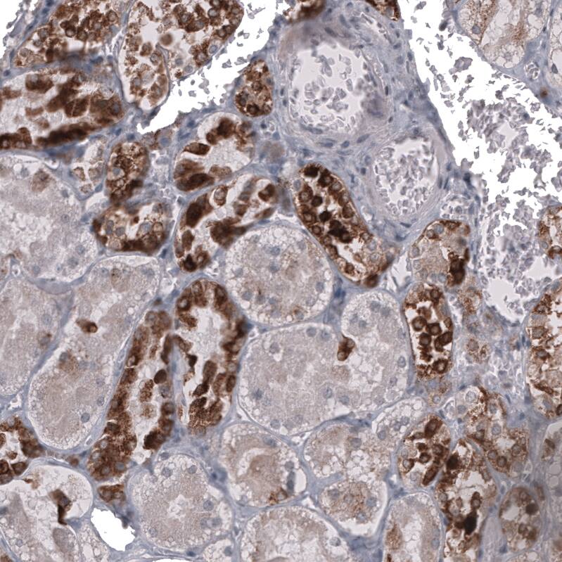 Staining of human kidney shows strong cytoplasmic positivity in a subset cells in tubules.